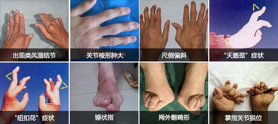 F(yng)(qing)ֱt(y)ԺL(fng)ָ_ֺȶ̎P(gun)(ji).jpg