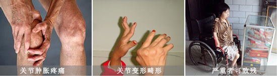 F(yng)(qing)ֱt(y)ԺL(fng)(hu)(do)P(gun)(ji)[ʹ.jpg