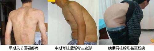 F(yng)(qing)ֱt(y)Ժ(qing)ֱԼײͬr(sh)ڰYF(xin).jpg