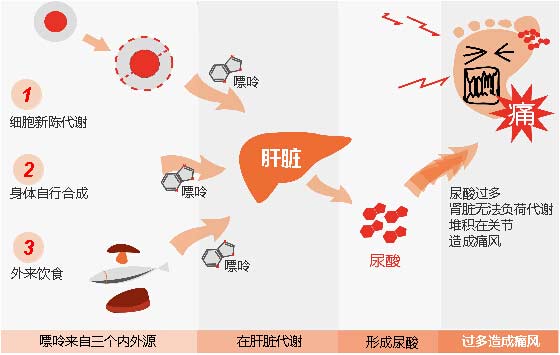 貴陽強直醫(yī)院痛風(fēng)形成原理.jpg